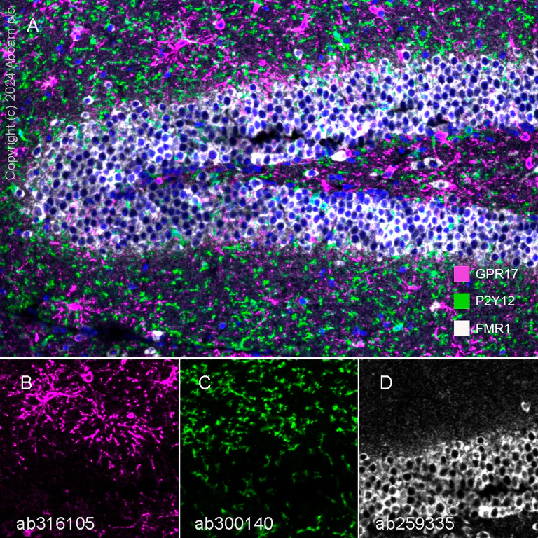 Multiplex immunohistochemistry - Anti-FMRP antibody [EPR23852-90] - BSA and Azide free (AB277489)