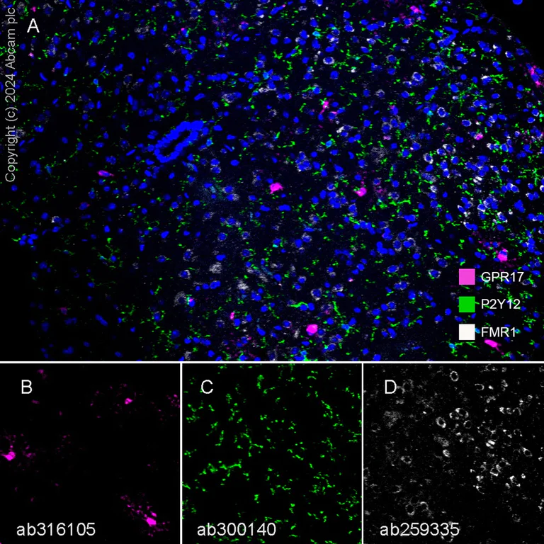 Multiplex immunohistochemistry - Anti-FMRP antibody [EPR23852-90] - BSA and Azide free (AB277489)