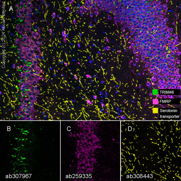 Multiplex immunohistochemistry - Anti-FMRP antibody [EPR23852-90] - BSA and Azide free (AB277489)