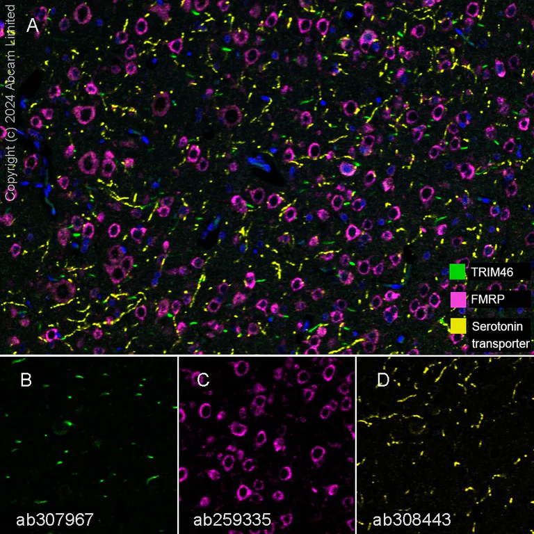 Multiplex immunohistochemistry - Anti-FMRP antibody [EPR23852-90] - BSA and Azide free (AB277489)