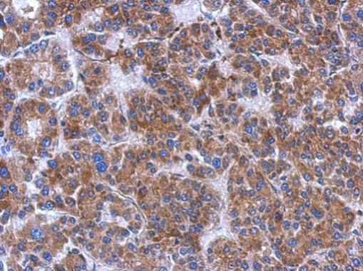 Immunohistochemistry (Formalin/PFA-fixed paraffin-embedded sections) - Anti-FN3K antibody (AB228639)
