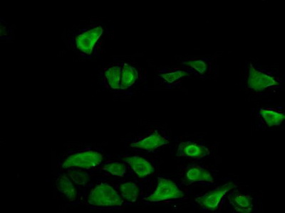 Immunocytochemistry/ Immunofluorescence - Anti-FN3K antibody (AB232766)