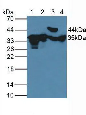 Western blot - Anti-FN3K antibody (AB232766)