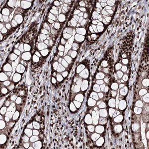 Immunohistochemistry (Formalin/PFA-fixed paraffin-embedded sections) - Anti-FNBP3 antibody (AB204371)