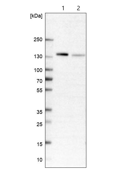 Western blot - Anti-FNBP3 antibody (AB204371), expandable thumbnail