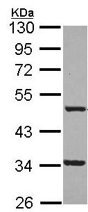 Western blot - Anti-FNTB antibody (AB154065), expandable thumbnail