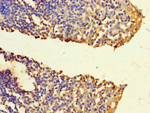 Immunohistochemistry (Formalin/PFA-fixed paraffin-embedded sections) - Anti-FNTB antibody (AB236649)