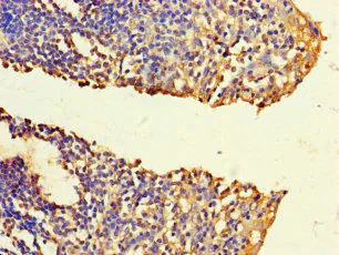 Immunohistochemistry (Formalin/PFA-fixed paraffin-embedded sections) - Anti-FNTB antibody (AB236649)
