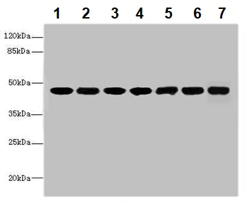 Western blot - Anti-FNTB antibody (AB236649)