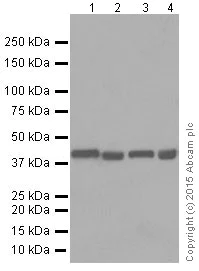 Western blot - Anti-FNTB antibody [EPR4706] (AB109748)