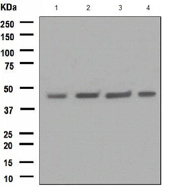 Western blot - Anti-FNTB antibody [EPR4706] (AB109748)