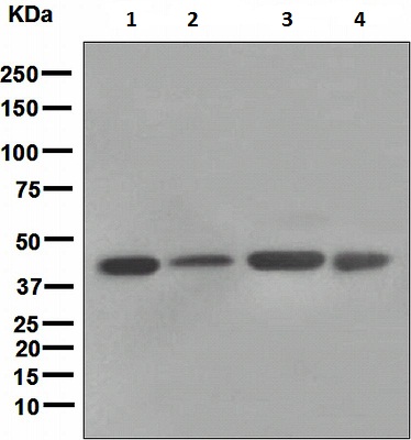 Western blot - Anti-FNTB antibody [EPR4707] (AB109625)