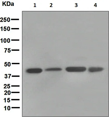 Western blot - Anti-FNTB antibody [EPR4707] (AB109625)