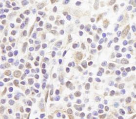 Immunohistochemistry (Formalin/PFA-fixed paraffin-embedded sections) - Anti-FOG1 antibody (AB84876)