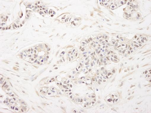 Immunohistochemistry (Formalin/PFA-fixed paraffin-embedded sections) - Anti-FOG1 antibody (AB84876)