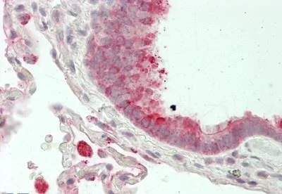 Immunohistochemistry (Formalin/PFA-fixed paraffin-embedded sections) - Anti-Folate Binding Protein/FBP antibody (AB230469)