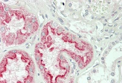 Immunohistochemistry (Formalin/PFA-fixed paraffin-embedded sections) - Anti-Folate Binding Protein/FBP antibody (AB230469)
