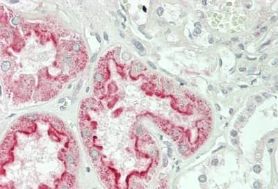 Immunohistochemistry (Formalin/PFA-fixed paraffin-embedded sections) - Anti-Folate Binding Protein/FBP antibody (AB230469)