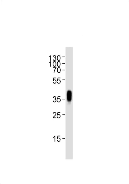 Western blot - Anti-Folate Binding Protein/FBP antibody (AB230469)