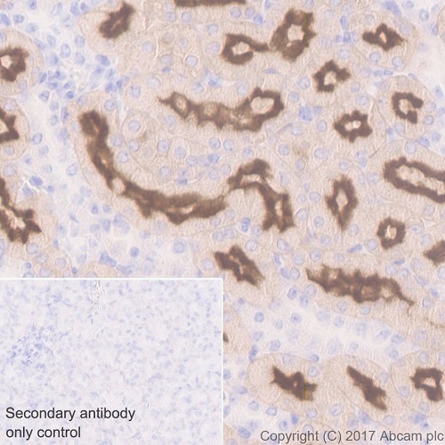 Immunohistochemistry (Formalin/PFA-fixed paraffin-embedded sections) - Anti-Folate Binding Protein/FBP antibody [EPR20277] (ab221543), expandable thumbnail