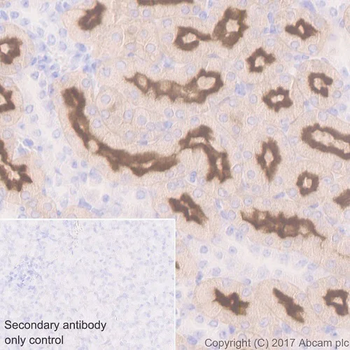 Immunohistochemistry (Formalin/PFA-fixed paraffin-embedded sections) - Anti-Folate Binding Protein/FBP antibody [EPR20277] (AB221543)