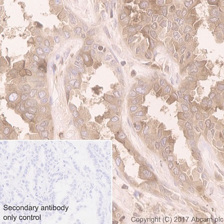Immunohistochemistry (Formalin/PFA-fixed paraffin-embedded sections) - Anti-Folate Binding Protein/FBP antibody [EPR20277] (ab221543), expandable thumbnail