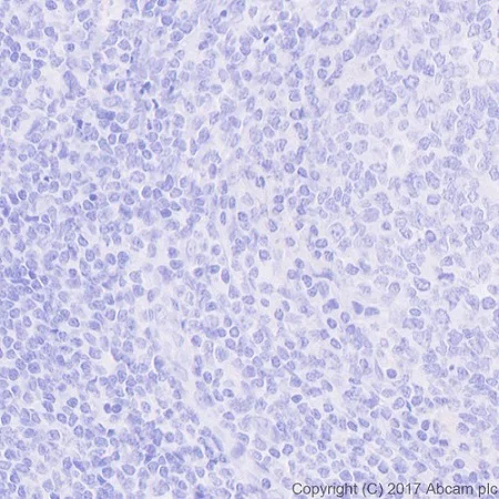 Immunohistochemistry (Formalin/PFA-fixed paraffin-embedded sections) - Anti-Folate Binding Protein/FBP antibody [EPR20277] (AB221543)