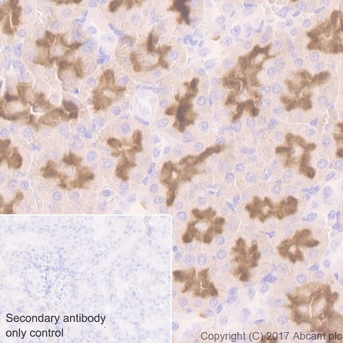 Immunohistochemistry (Formalin/PFA-fixed paraffin-embedded sections) - Anti-Folate Binding Protein/FBP antibody [EPR20277] (ab221543), expandable thumbnail