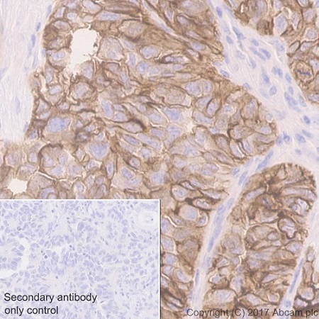 Immunohistochemistry (Formalin/PFA-fixed paraffin-embedded sections) - Anti-Folate Binding Protein/FBP antibody [EPR20277] (ab221543), expandable thumbnail
