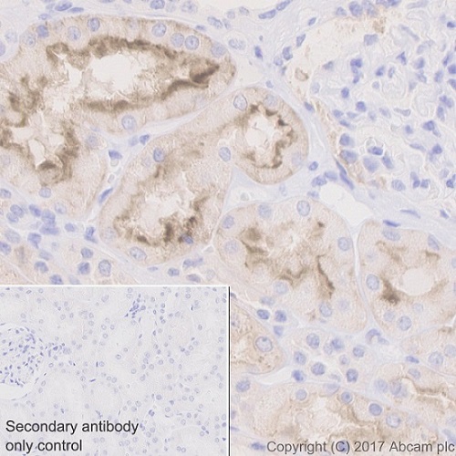 Immunohistochemistry (Formalin/PFA-fixed paraffin-embedded sections) - Anti-Folate Binding Protein/FBP antibody [EPR20277] (AB221543), expandable thumbnail