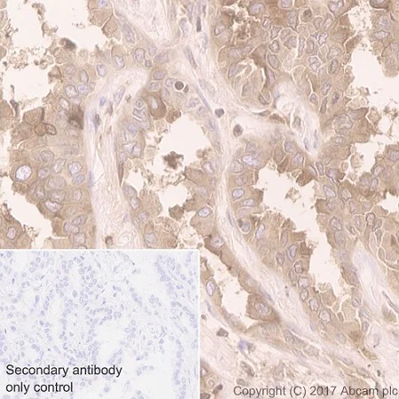 Immunohistochemistry (Formalin/PFA-fixed paraffin-embedded sections) - Anti-Folate Binding Protein/FBP antibody [EPR20277] - BSA and Azide free (AB235140)