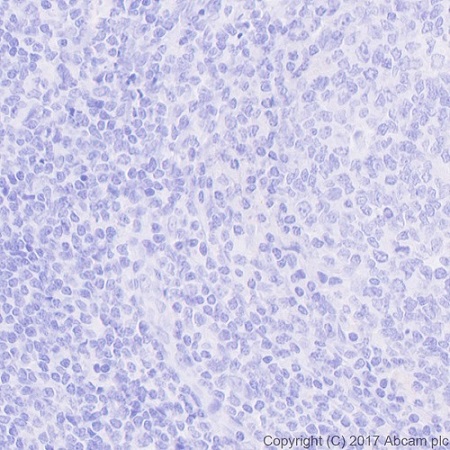 Immunohistochemistry (Formalin/PFA-fixed paraffin-embedded sections) - Anti-Folate Binding Protein/FBP antibody [EPR20277] - BSA and Azide free (AB235140)