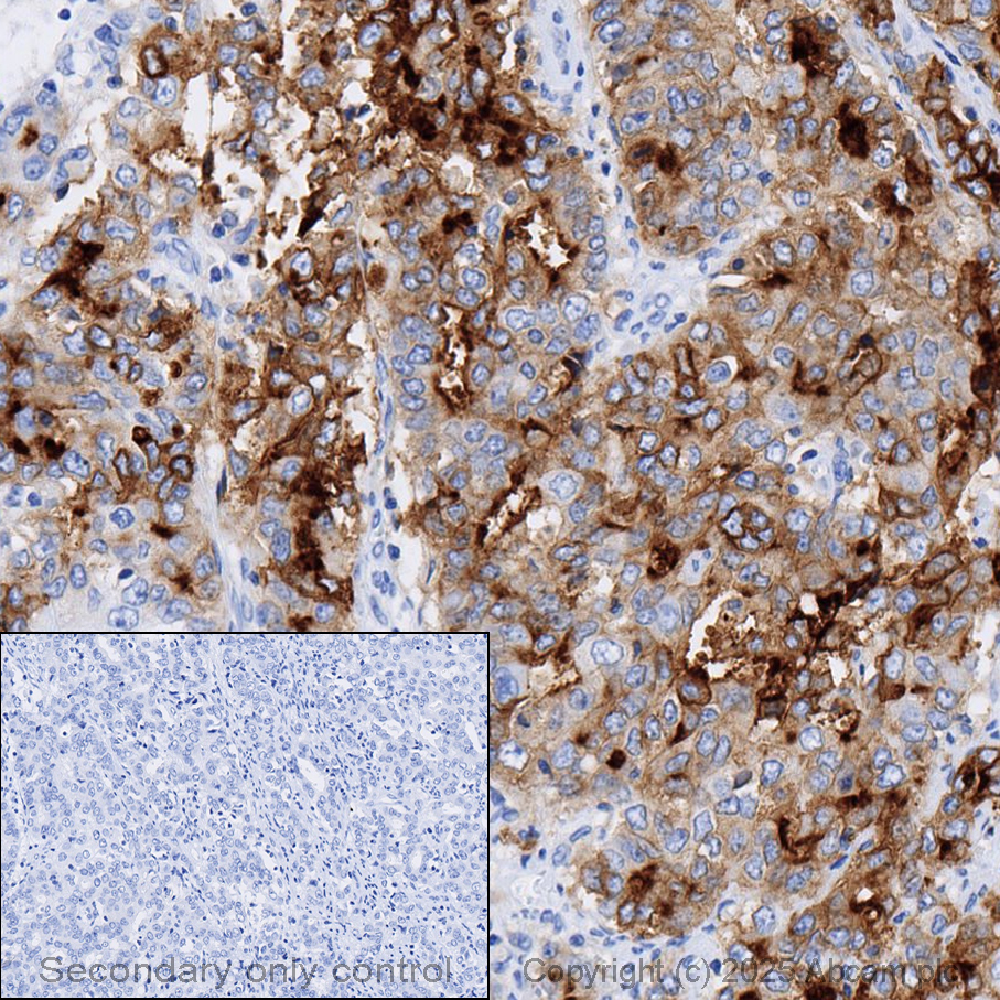 Immunohistochemistry (Formalin/PFA-fixed paraffin-embedded sections) - Anti-Folate Binding Protein/FBP antibody [EPR20277] - BSA and Azide free (AB235140)
