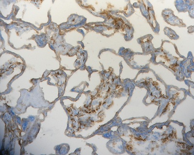 Immunohistochemistry (Frozen sections) - Anti-Folate Binding Protein/FBP antibody [LK26] (AB3361)