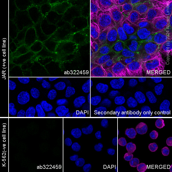 Immunocytochemistry/ Immunofluorescence - Anti-Folate Binding Protein/FBP antibody [RM1246] (AB322459), expandable thumbnail