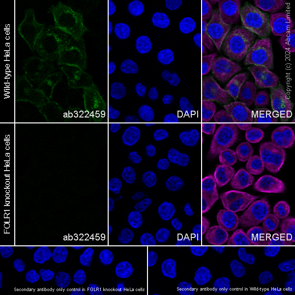 Immunocytochemistry/ Immunofluorescence - Anti-Folate Binding Protein/FBP antibody [RM1246] (AB322459), expandable thumbnail