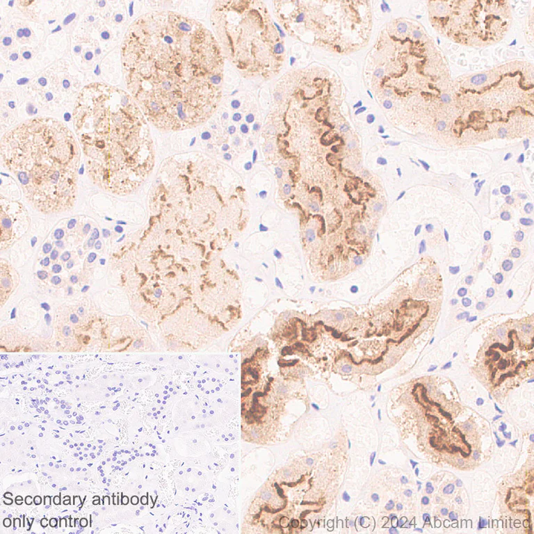Immunohistochemistry (Formalin/PFA-fixed paraffin-embedded sections) - Anti-Folate Binding Protein/FBP antibody [RM1246] (AB322459)