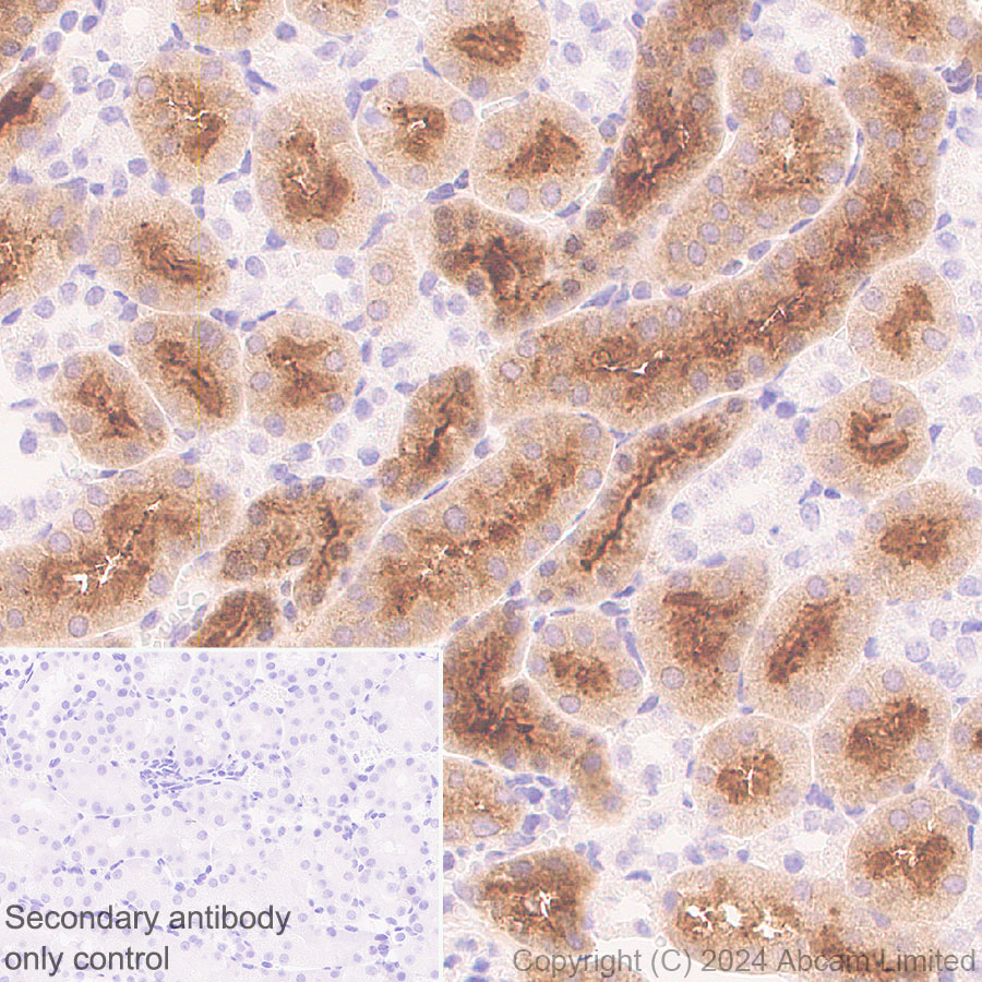 Immunohistochemistry (Formalin/PFA-fixed paraffin-embedded sections) - Anti-Folate Binding Protein/FBP antibody [RM1246] (ab322459), expandable thumbnail