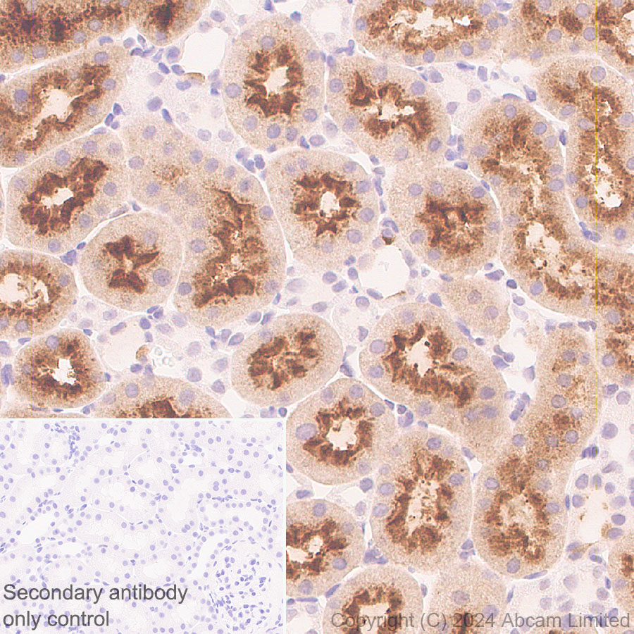 Immunohistochemistry (Formalin/PFA-fixed paraffin-embedded sections) - Anti-Folate Binding Protein/FBP antibody [RM1246] (ab322459), expandable thumbnail