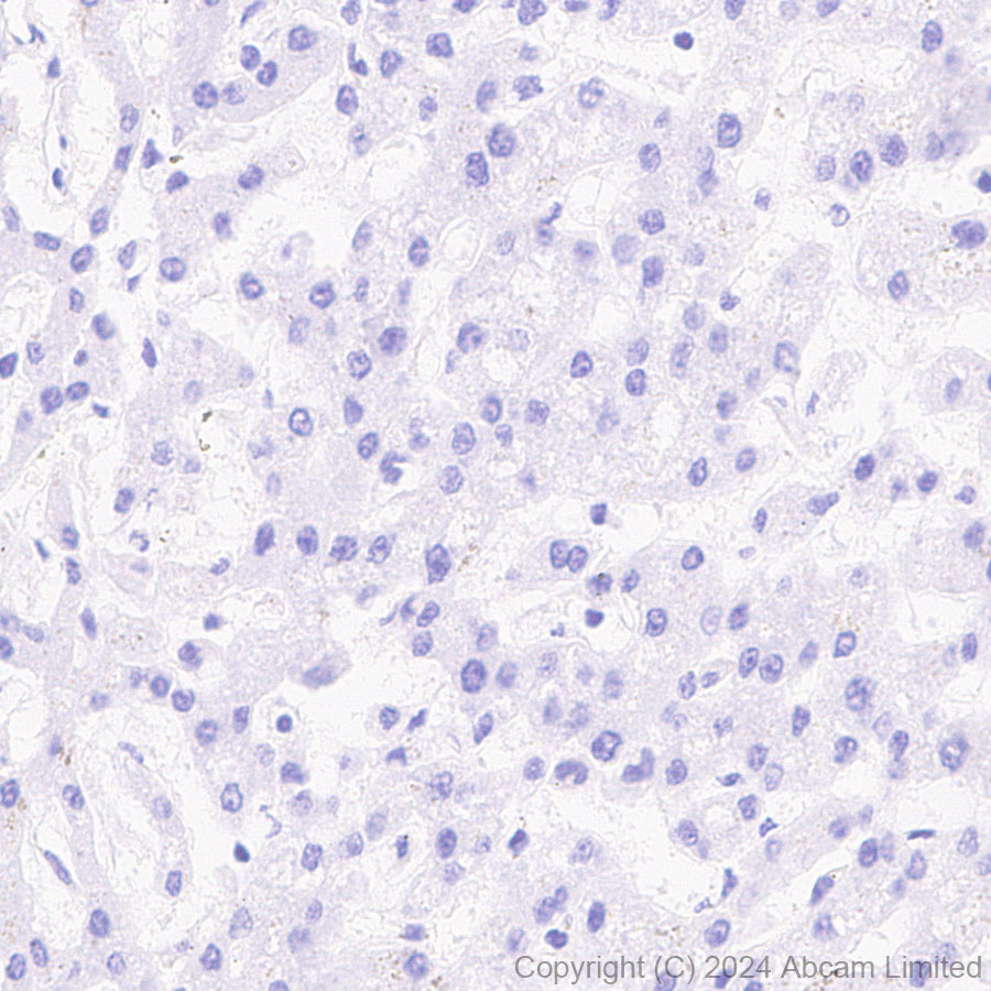 Immunohistochemistry (Formalin/PFA-fixed paraffin-embedded sections) - Anti-Folate Binding Protein/FBP antibody [RM1246] (ab322459), expandable thumbnail