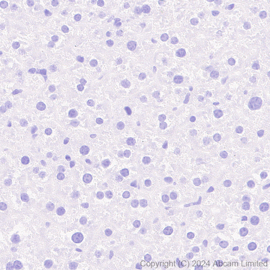 Immunohistochemistry (Formalin/PFA-fixed paraffin-embedded sections) - Anti-Folate Binding Protein/FBP antibody [RM1246] (ab322459), expandable thumbnail