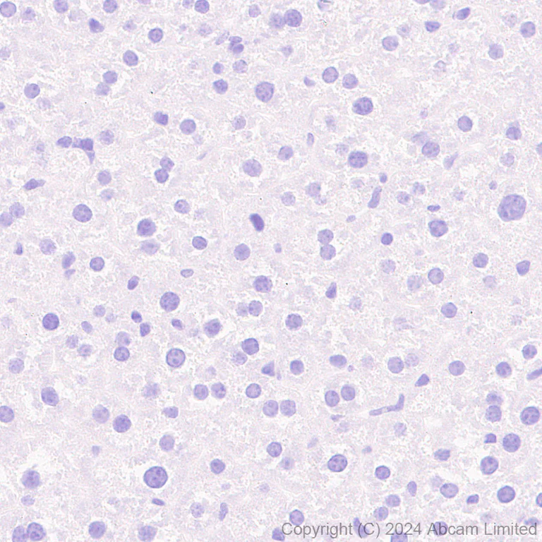 Immunohistochemistry (Formalin/PFA-fixed paraffin-embedded sections) - Anti-Folate Binding Protein/FBP antibody [RM1246] (AB322459)