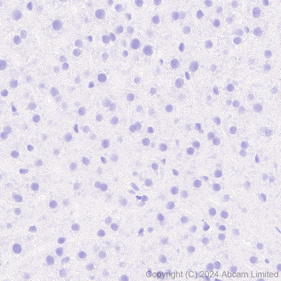 Immunohistochemistry (Formalin/PFA-fixed paraffin-embedded sections) - Anti-Folate Binding Protein/FBP antibody [RM1246] (ab322459), expandable thumbnail