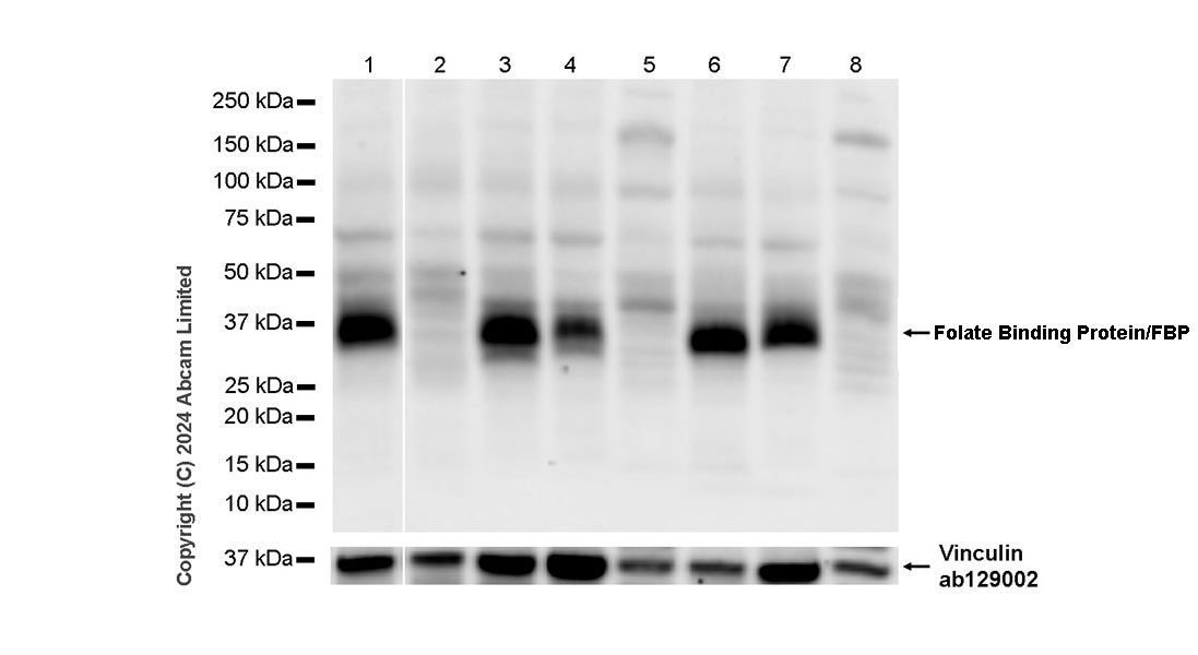 Western blot - Anti-Folate Binding Protein/FBP antibody [RM1246] (ab322459), expandable thumbnail