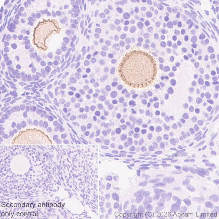 Immunohistochemistry (Formalin/PFA-fixed paraffin-embedded sections) - Anti-Folate Receptor 4 antibody [EPR30390-515] - BSA and Azide free (AB327712)
