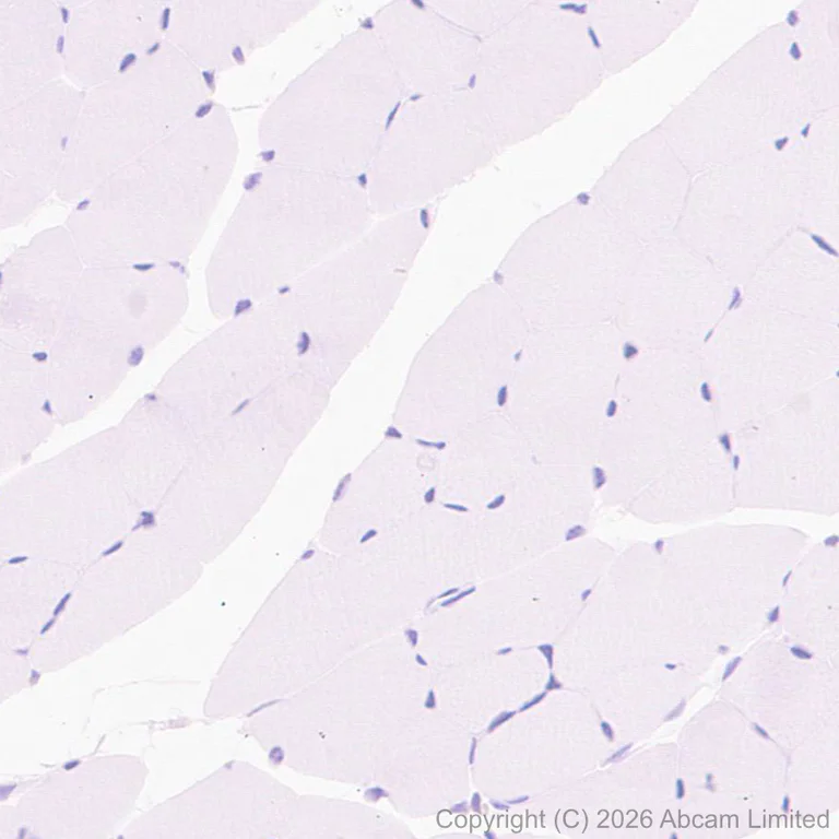 Immunohistochemistry (Formalin/PFA-fixed paraffin-embedded sections) - Anti-Folate Receptor 4 antibody [EPR30390-515] - BSA and Azide free (AB327712)