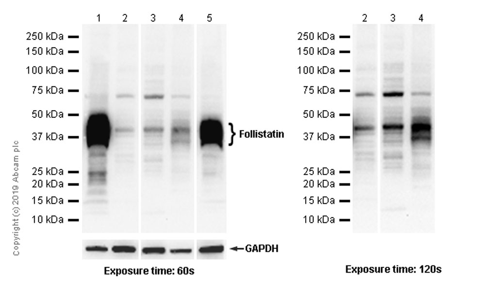 Western blot - Anti-Follistatin antibody [EPR10903] - BSA and Azide free (AB249335)