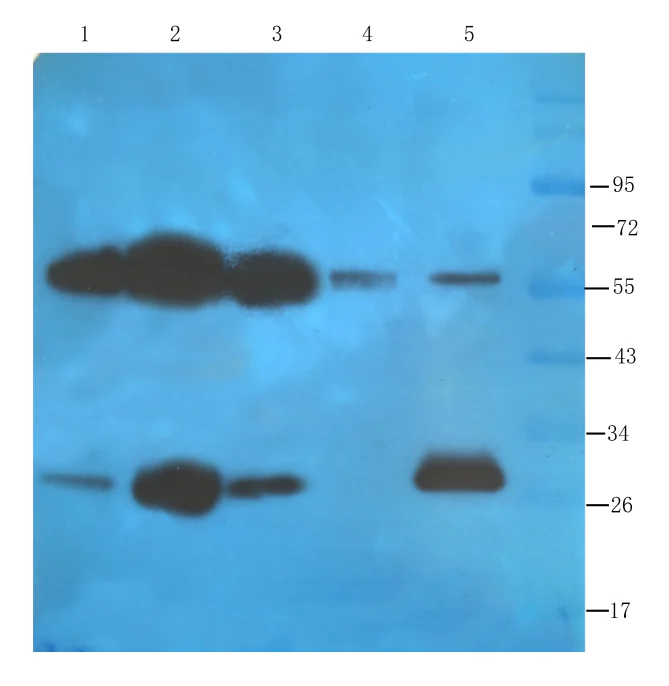 Western blot - Anti-FOLR2 antibody [CL10] (AB288431)