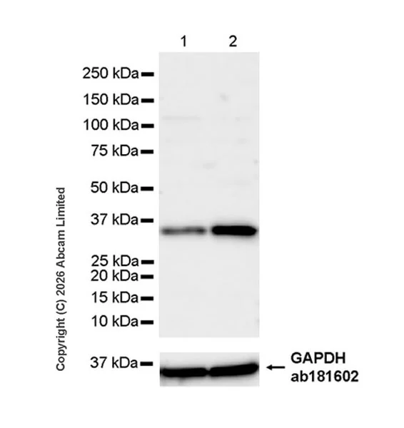 Western blot - Anti-FOLR2 antibody [EPR30335-548] (AB325399)