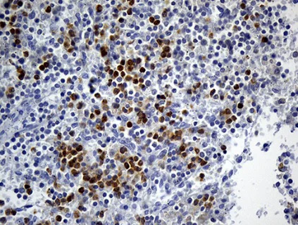 Immunohistochemistry (Formalin/PFA-fixed paraffin-embedded sections) - Anti-FOLR3 antibody [OTI6C1] (AB236384)